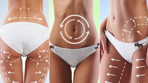 Pack de 5 sesiones de presoterapia médica por 30€