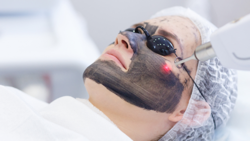 Tratamiento facial Peeling “Hollywood” por 40 €
