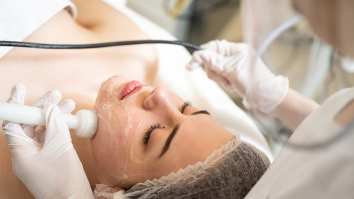 Radiofrecuencia INDIBA facial desde 30 euros